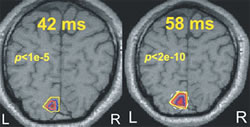 Fig. 1: The first V1 activation (left) and its reactivation (right) as seen by MEG (red and yellow contours). The solutions agree remarkably well with the fMRI results (blue contour)