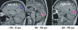 Fig. 2: Parietal areas (left) are activated before stimulus onset modulating the responses in V1 (middle) and extrastriate areas (right) (Poghosyan et al., submitted)