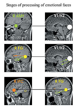 図4：感情的な表情の認識課題における処理段階。右扁桃体とVI間の主要な連携を伴う極初期段階（上）、VIと右紡錘状回に活動が集中する段階（中央）、右紡錘状回と右下前頭葉における強力な局所的活動が連携している後期段階（下）