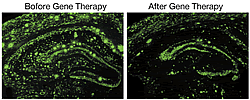 Fig.3: Amyloid deposition is significantly reduced (green fluorescent color) (left) in the Alzheimer’s disease model mouse due to increased neprilysin enzyme activity (right).