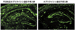 図3：アルツハイマー病モデルマウス海馬でのアミロイド沈着（緑色の蛍光色）（左）が、ネプリライシン遺伝子を導入して酵素活性を増強することにより顕著に抑制されている（右）
