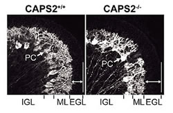 図3：CAPS2ノックアウトマウスにおける小脳低形成