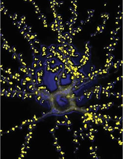 Fig.1: A hippocampal neuron with hundreds of synapses situated on dendritic spines (shown in yellow).