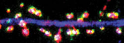 Fig.2: Close up view of large dendritic spines (red) with associated synapses (green/white) protruding from the shaft of a neuronal dendrite (blue).