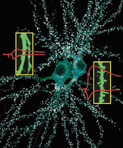 図3：2個の隣接した海馬神経細胞