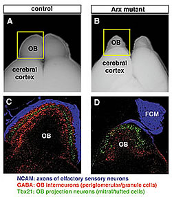 Fig.1: Mouse Olfactory Bulb; Control (Left) and Arx-Deficient (Right).