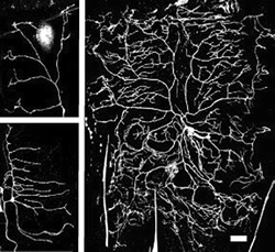 Different shapes of fruit fly larval sensory neurons (white bar = 40μm)