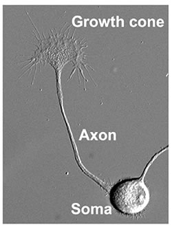 Fig.1: The soma, axon and growth cone of a chicken sensory neuron.