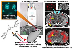 Fig: Mouse brain senile plaques revealed with FSB and fluorine MRI