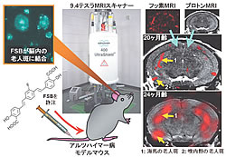 図：FSBとフッ素MRIによるマウス脳老人班の画像化