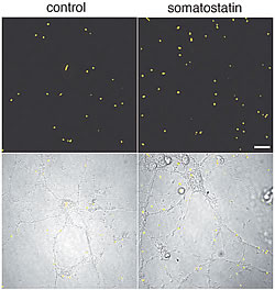 Fig.1: In vitro screening for neprilysin activating factors using primary neurons