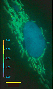 図2：本研究に用いた細胞の蛍光顕微鏡写真