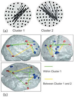 Fig. 2: Brain networks emerging through theta phase synchronization during continuous subtraction tasks.(ref3)