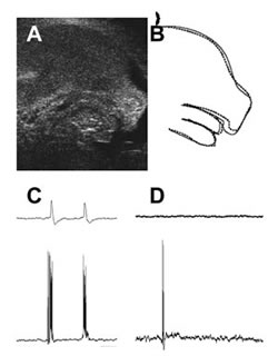 Fig.3: Brainstem and head movement in GAD knockout mouse