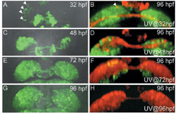 Fig. 2: Visualization of Left-Right Asymmetrical Neural Differentiation Using Transgenic Fis