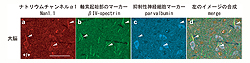 図2：パルブアルブミン陽性抑制性神経細胞軸索起始部におけるNav1.1チャネルの発現