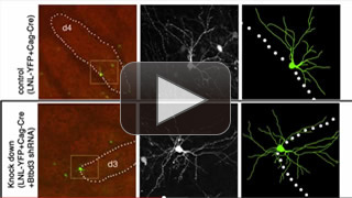 BTBD3が効率的な神経ネットワークを形成 