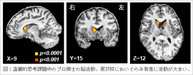 図：直観的思考課題中のプロ棋士の脳活動。尾状核においてのみ有意に活動が大きい。