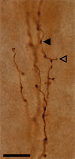 図1：トレーサ注入によって順向性に標識された皮質軸索の終末分枝。