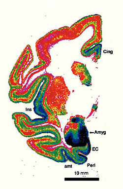 Fig. 3: Zinc positive terminations are particularly dense (purple) in the amgydala (and, not shown, hippocampus) as well the medial and ventromedial limbic cortices, and insular cortex.